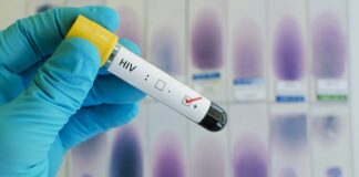 HIV / AIDS | Foto; Divulgação