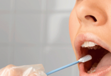Teste AG Oral (saliva) | Foto: Internet
